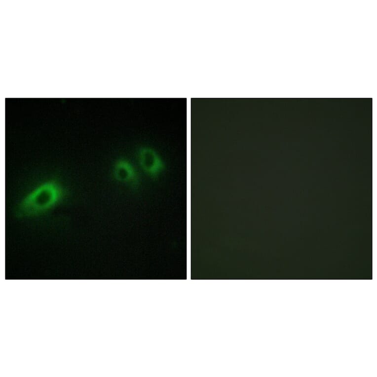 Immunofluorescence - Anti-LAMB1 Antibody (C13069) - Antibodies.com