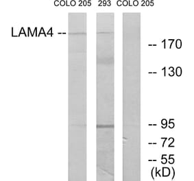 Western Blot - Anti-LAMA4 Antibody (C13067) - Antibodies.com