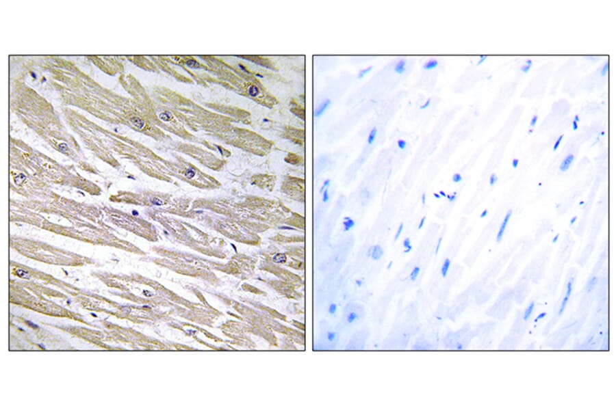 Immunohistochemistry - Anti-LAMA4 Antibody (C13067) - Antibodies.com