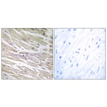 Immunohistochemistry - Anti-LAMA4 Antibody (C13067) - Antibodies.com