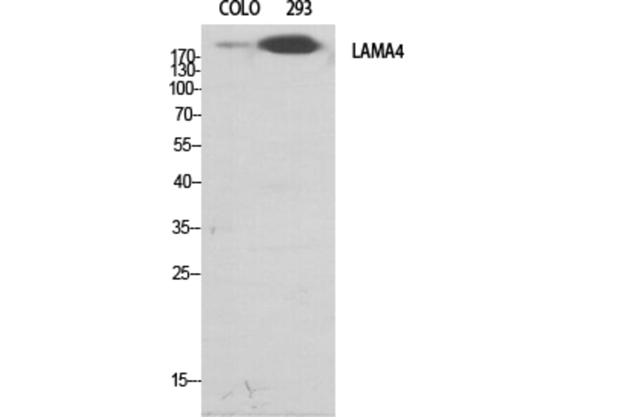 Western Blot - Anti-LAMA4 Antibody (C13067) - Antibodies.com