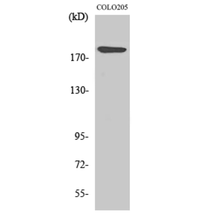 Western Blot - Anti-LAMA4 Antibody (C13067) - Antibodies.com