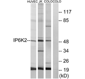 Western Blot - Anti-IP6K2 Antibody (C11845) - Antibodies.com