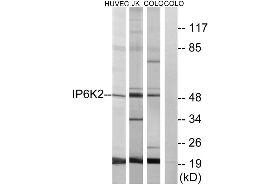 Western Blot - Anti-IP6K2 Antibody (C11845) - Antibodies.com