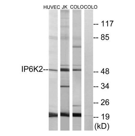 Western Blot - Anti-IP6K2 Antibody (C11845) - Antibodies.com