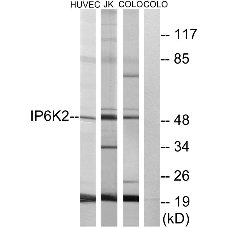 Western Blot - Anti-IP6K2 Antibody (C11845) - Antibodies.com