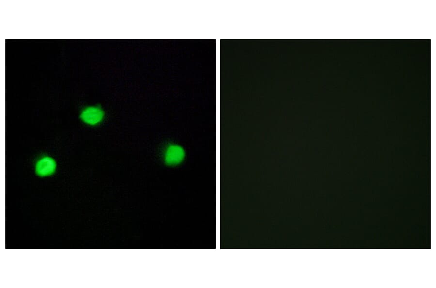 Immunofluorescence - Anti-IP6K2 Antibody (C11845) - Antibodies.com