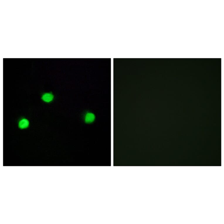 Immunofluorescence - Anti-IP6K2 Antibody (C11845) - Antibodies.com