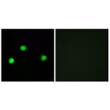 Immunofluorescence - Anti-IP6K2 Antibody (C11845) - Antibodies.com