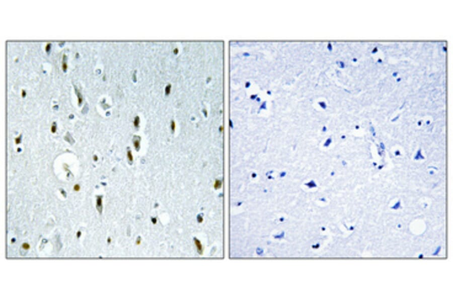 Immunohistochemistry - Anti-IP6K2 Antibody (C11845) - Antibodies.com