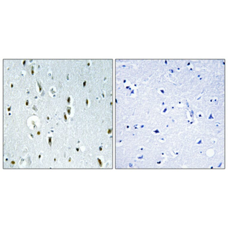 Immunohistochemistry - Anti-IP6K2 Antibody (C11845) - Antibodies.com