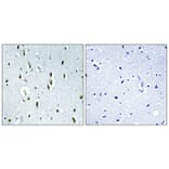 Immunohistochemistry - Anti-IP6K2 Antibody (C11845) - Antibodies.com