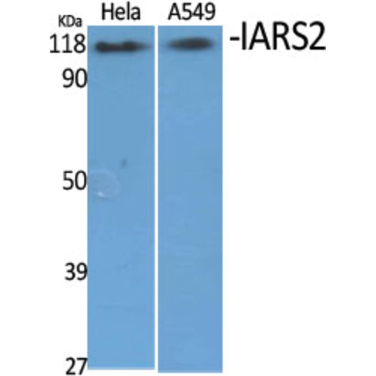 Western Blot - Anti-IARS2 Antibody (C11759) - Antibodies.com