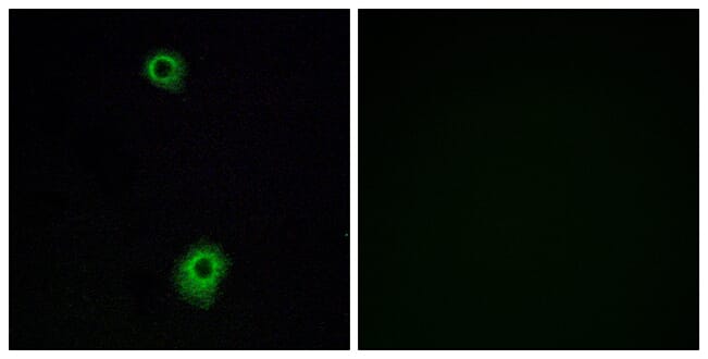 Immunofluorescence analysis of A549 cells using Anti-HTR1B Antibody. The right hand panel represents a negative control, where the antibody was pre-incubated with the immunising peptide.