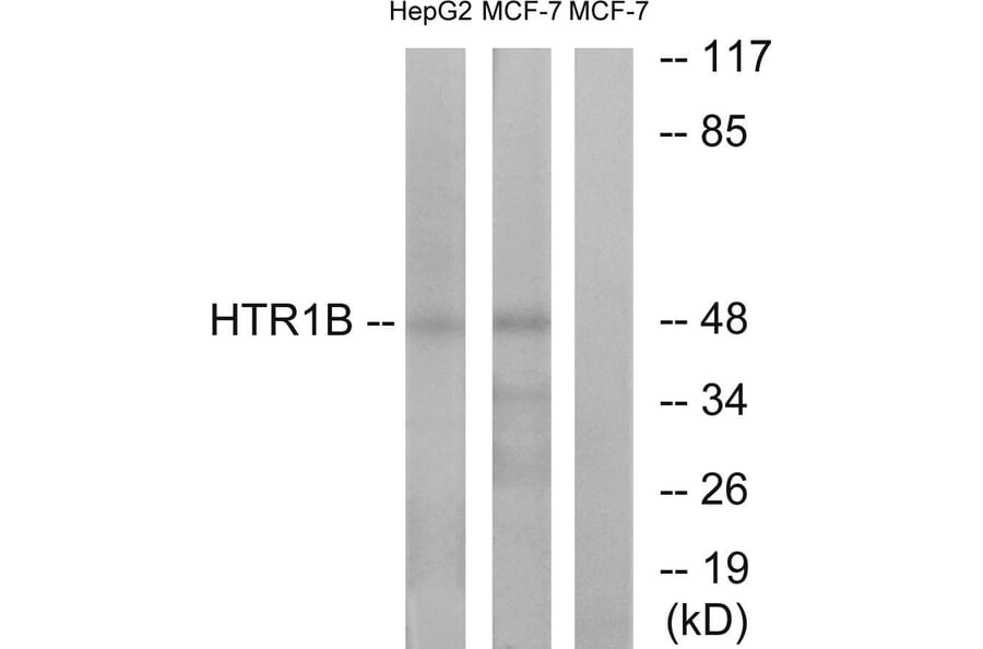 Western Blot - Anti-HTR1B Antibody (G002) - Antibodies.com