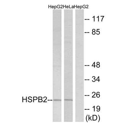 Western Blot - Anti-HSPB2 Antibody (C12418) - Antibodies.com