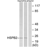 Western Blot - Anti-HSPB2 Antibody (C12418) - Antibodies.com