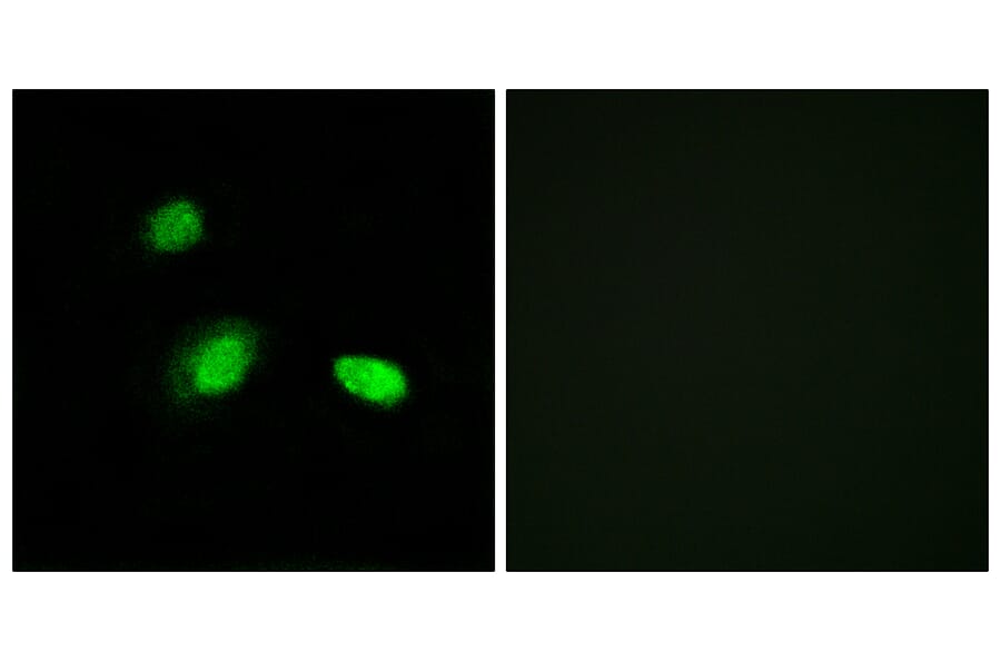 Immunofluorescence - Anti-HSPB2 Antibody (C12418) - Antibodies.com