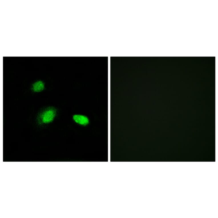 Immunofluorescence - Anti-HSPB2 Antibody (C12418) - Antibodies.com