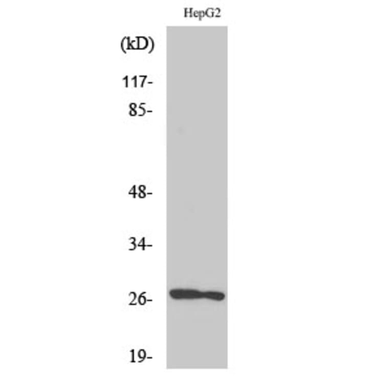 Western Blot - Anti-HSPB2 Antibody (C12418) - Antibodies.com