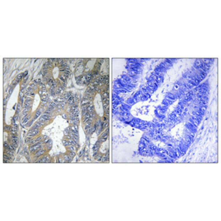 Immunohistochemistry - Anti-HSPB2 Antibody (C12418) - Antibodies.com