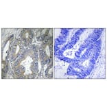 Immunohistochemistry - Anti-HSPB2 Antibody (C12418) - Antibodies.com