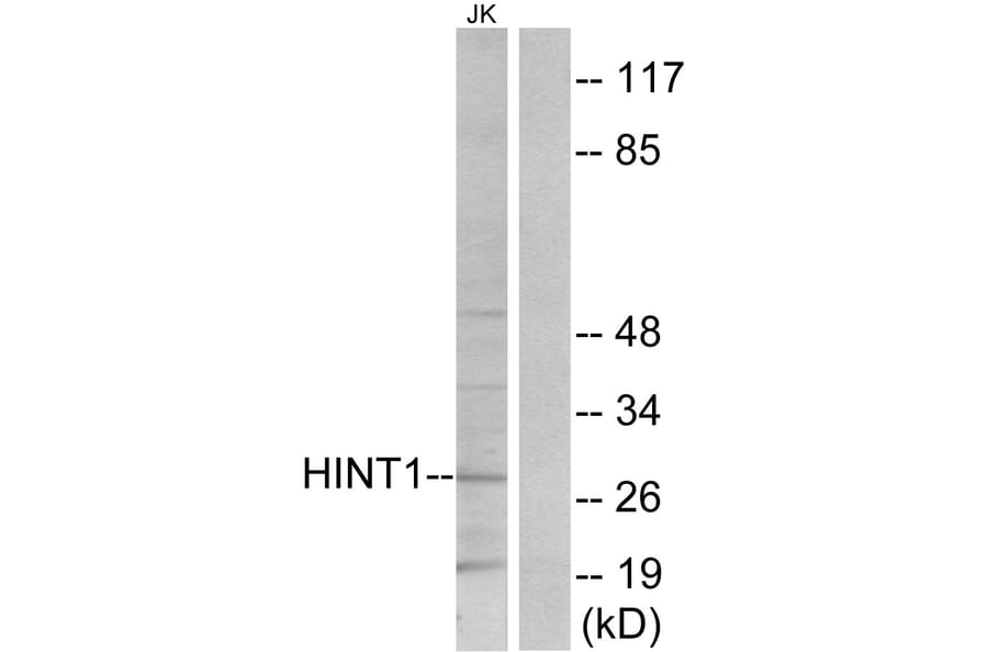 Western Blot - Anti-HINT1 Antibody (C10655) - Antibodies.com