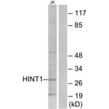 Western Blot - Anti-HINT1 Antibody (C10655) - Antibodies.com