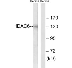Western Blot - Anti-HDAC6 Antibody (B0941) - Antibodies.com
