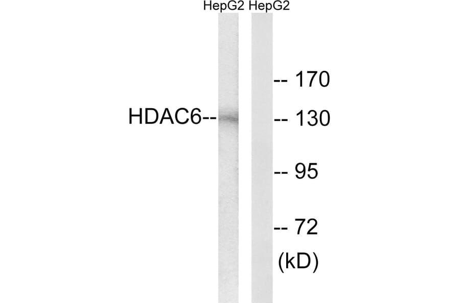Western Blot - Anti-HDAC6 Antibody (B0941) - Antibodies.com