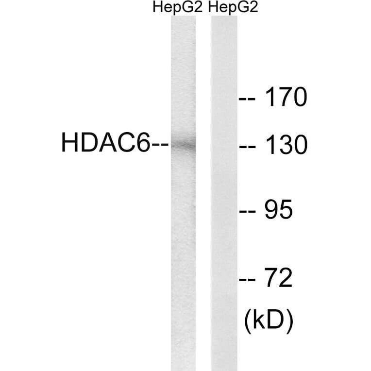 Western Blot - Anti-HDAC6 Antibody (B0941) - Antibodies.com