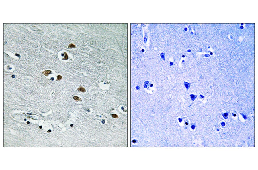 Immunohistochemistry - Anti-HDAC6 Antibody (B0941) - Antibodies.com