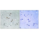 Immunohistochemistry - Anti-HDAC6 Antibody (B0941) - Antibodies.com
