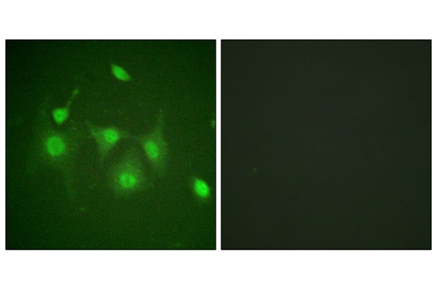 Immunofluorescence - Anti-HDAC6 Antibody (B0941) - Antibodies.com