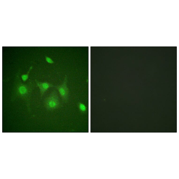 Immunofluorescence - Anti-HDAC6 Antibody (B0941) - Antibodies.com