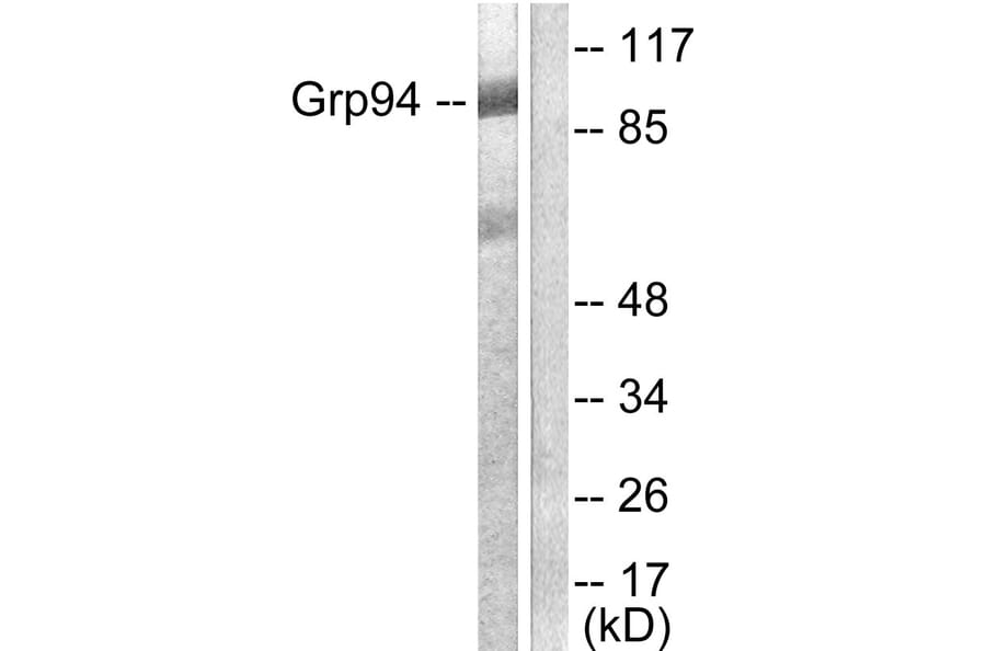 Western Blot - Anti-GRP94 Antibody (C0218) - Antibodies.com