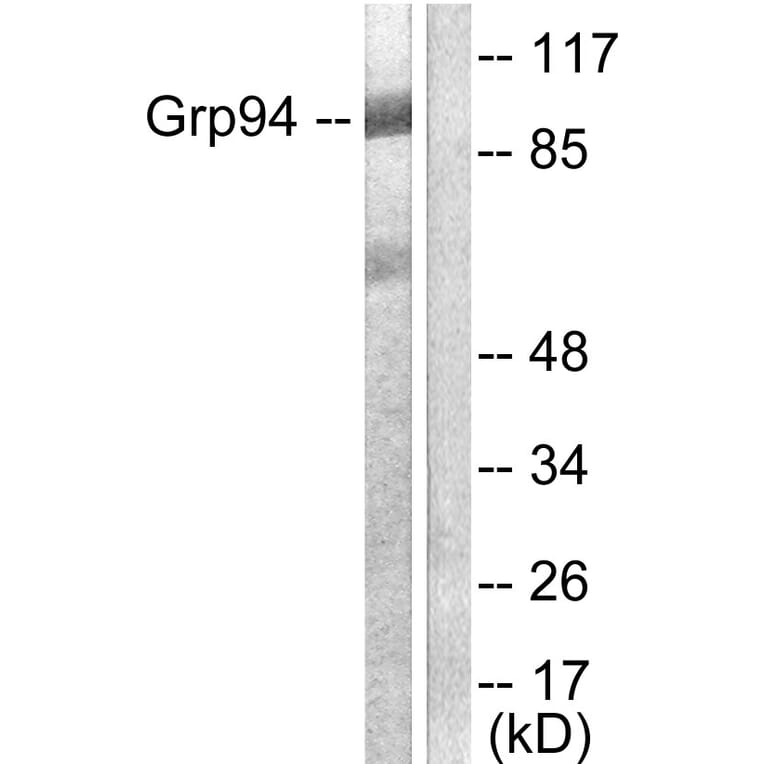 Western Blot - Anti-GRP94 Antibody (C0218) - Antibodies.com