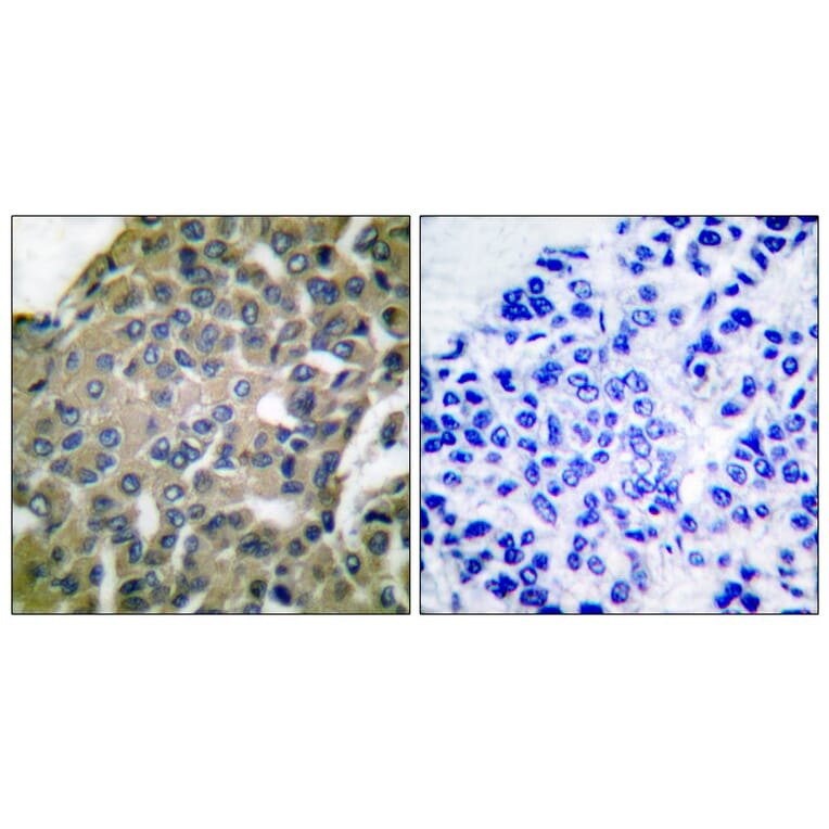 Immunohistochemistry - Anti-GRP94 Antibody (C0218) - Antibodies.com