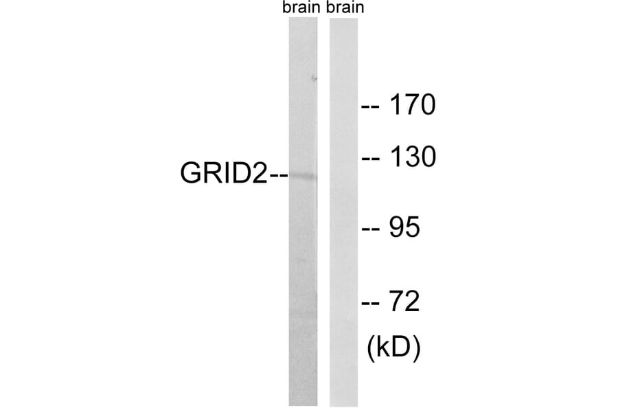 Western Blot - Anti-GRID2 Antibody (C12395) - Antibodies.com