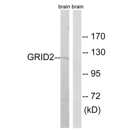 Western Blot - Anti-GRID2 Antibody (C12395) - Antibodies.com