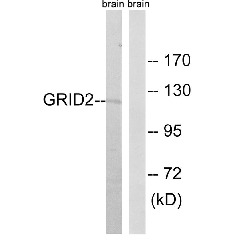 Western Blot - Anti-GRID2 Antibody (C12395) - Antibodies.com