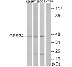 Western Blot - Anti-GPR34 Antibody (G337) - Antibodies.com