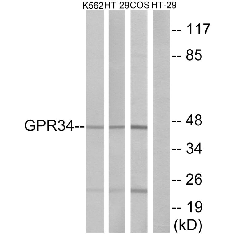 Western Blot - Anti-GPR34 Antibody (G337) - Antibodies.com