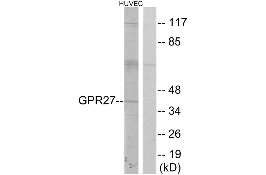 Western Blot - Anti-GPR27 Antibody (G333) - Antibodies.com