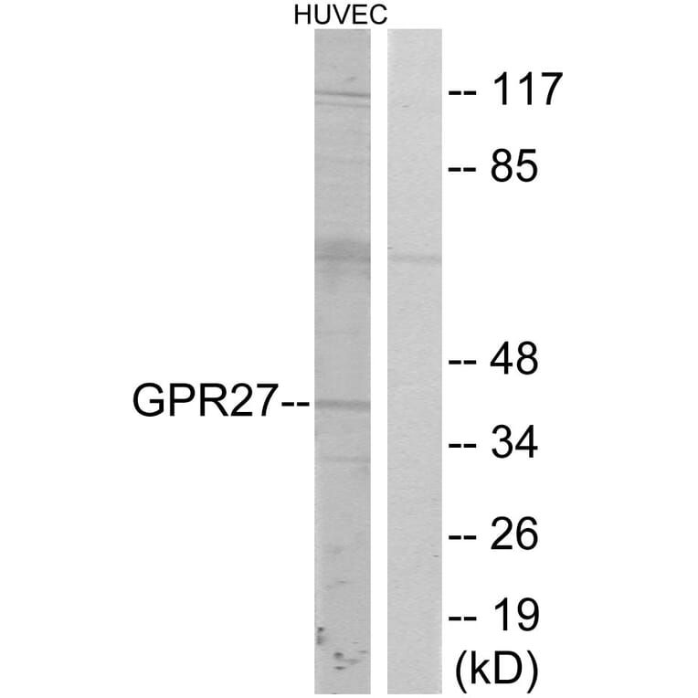 Western Blot - Anti-GPR27 Antibody (G333) - Antibodies.com