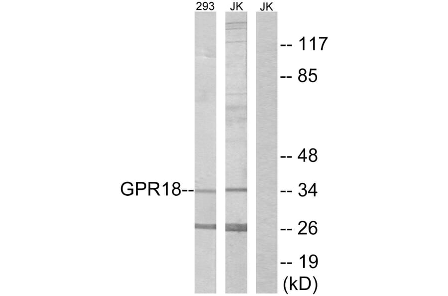 Western Blot - Anti-GPR18 Antibody (G326) - Antibodies.com