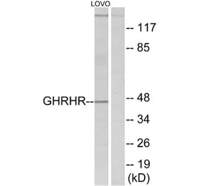 Western Blot - Anti-GHRHR Antibody (G271) - Antibodies.com
