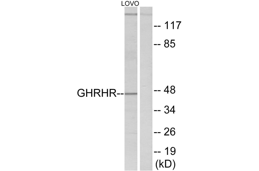 Western Blot - Anti-GHRHR Antibody (G271) - Antibodies.com