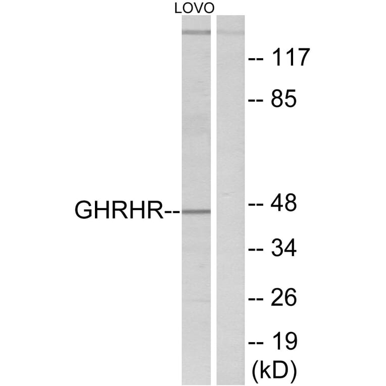 Western Blot - Anti-GHRHR Antibody (G271) - Antibodies.com