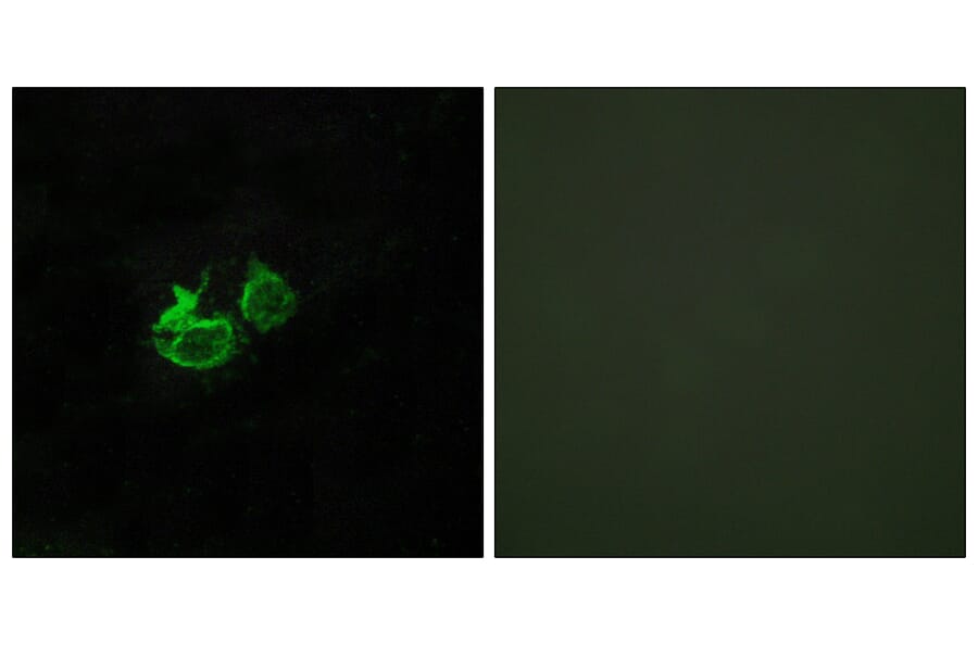 Immunofluorescence - Anti-GHRHR Antibody (G271) - Antibodies.com